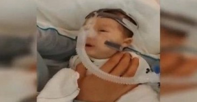 Hastaligina Hollanda Ve Fas Ta Care Bulunamadi Yusuf Bebek Turkiye Ye Getiriliyor H76692 C22Ac